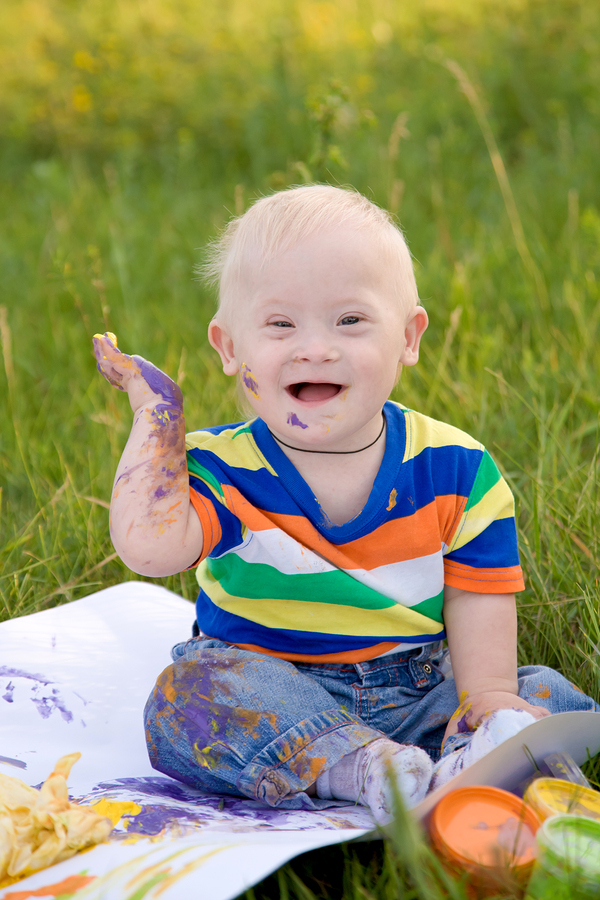 baby boy with Down syndrome - Gee Whiz Education
